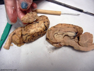 Sheep Brain Dissection With Labeled Images