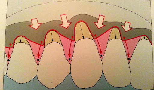 Dr Escaut André - Parodontiste - parodontologie, implants dentaires, couronnes dentaires