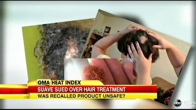 「トリートメント剤で髪が抜けた」と、米で集団訴訟されている製品を調べると日本ではありえない成分が含まれていた。
