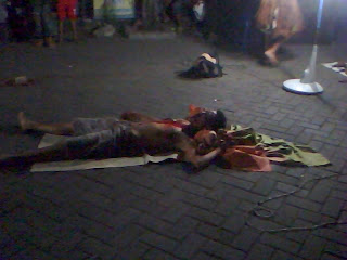 Cruel! This Boy's Neck Almost Separates From His Body -- imroee