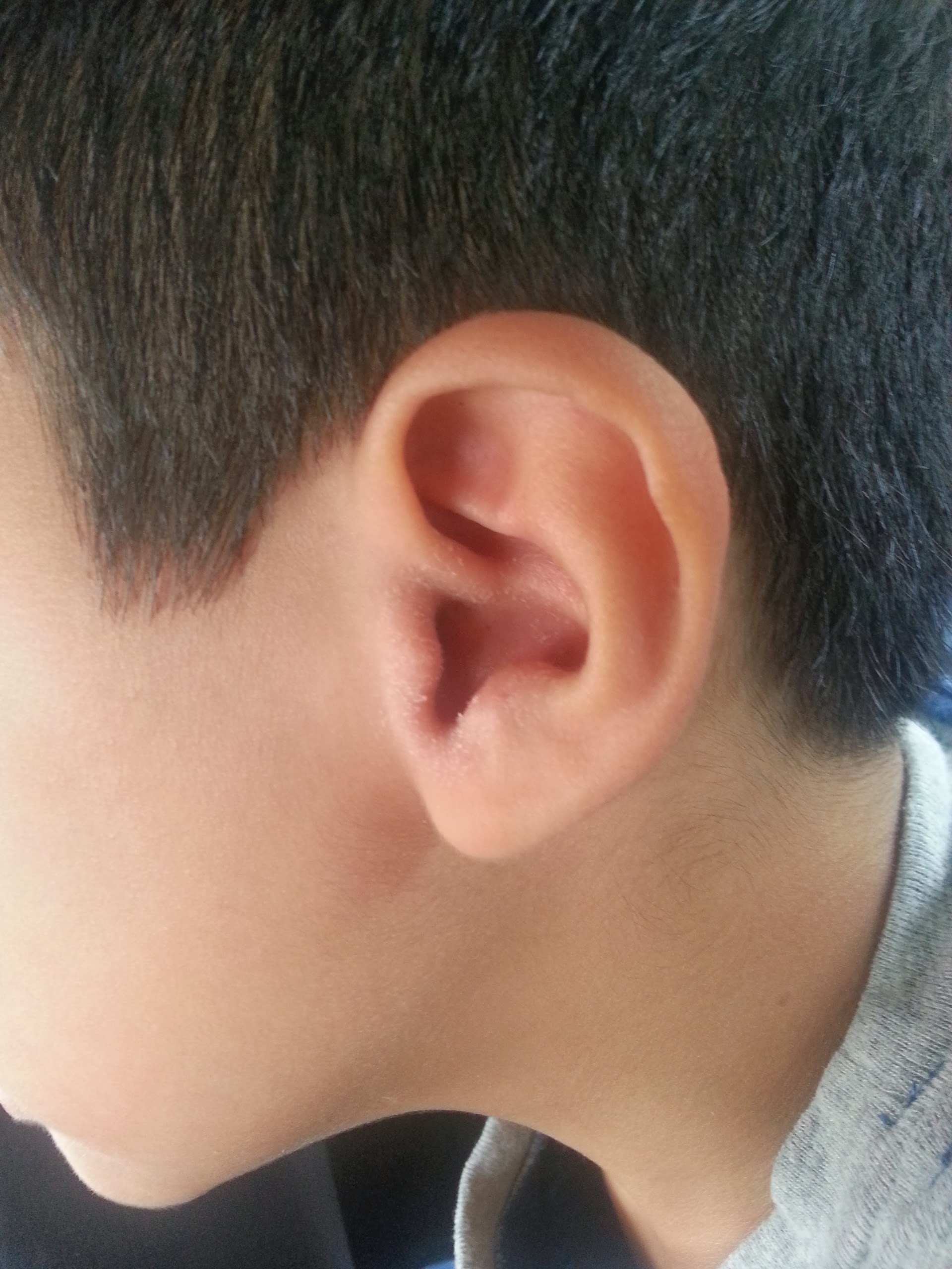 Anakku akif: Sambungan cerita telinga akif