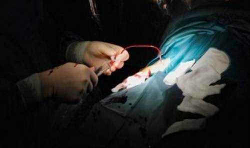 Egyptians Perform Surgery Under Mobile Phone Light