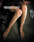 STD poster lady lower torso legs panties knee burns all you need to catch an std