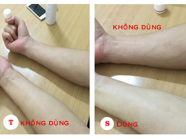 HÌNH ẢNH THỰC TẾ TRƯỚC VÀ SAU KHI SỬ DỤNG TẤT PHUN NUDE STOCKING HÌNH ẢNH THỰC TẾ TRƯỚC VÀ SAU KHI SỬ DỤNG TẤT PHUN NUDE STOCKING