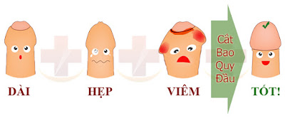 Lợi ích của cắt bao quy đầu đối với sức khỏe sinh sản Lợi ích của cắt bao quy đầu đối với sức khỏe sinh sản