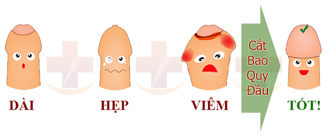 Có cần phải cắt bao quy đầu khi không hẹp lắm? Có cần phải cắt bao quy đầu khi không hẹp lắm?
