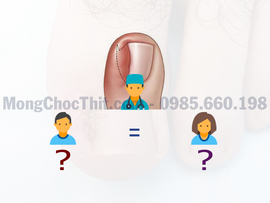 sưng khoé chân khoé chân chảy mủ