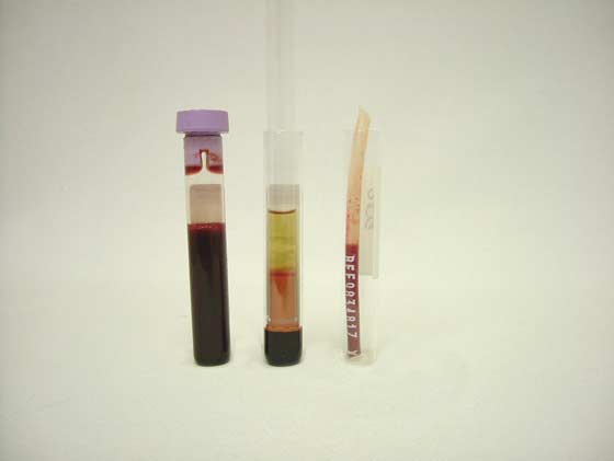 Sources of donor red blood cells