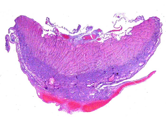 Cross section of the placenta with the artifactual (freezing-induced) pink labyrinth and blue basal spongy zone (trophospongium).