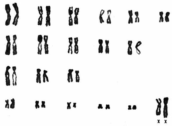 Karyotype of female beaver