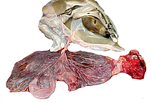 Amnion with content delivered from allantoic sac showing the very short allantoic portion of umbilical cord