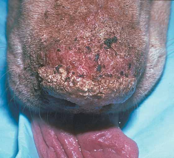 Pemphigus foliaceus with depigmentation, erosions, and crusting in a 7-year-old male Golden Retriever