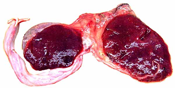 Maternal aspect of the same delivered placenta from a tufted deer.