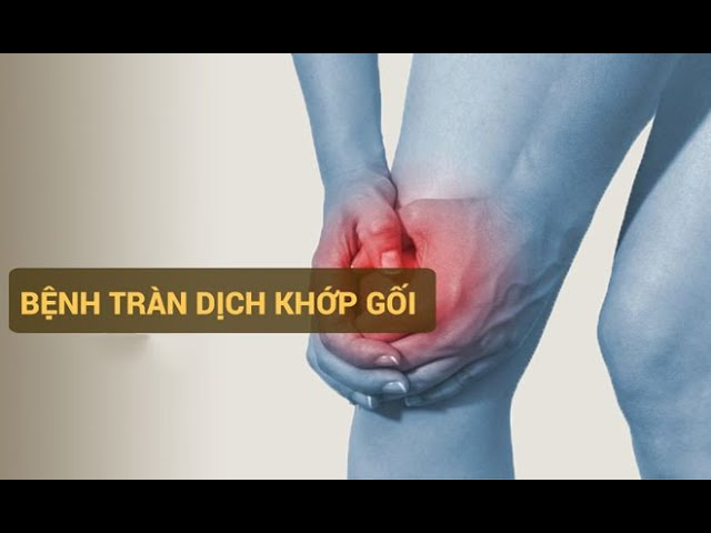 tràn dịch khớp gối uống thuốc gì