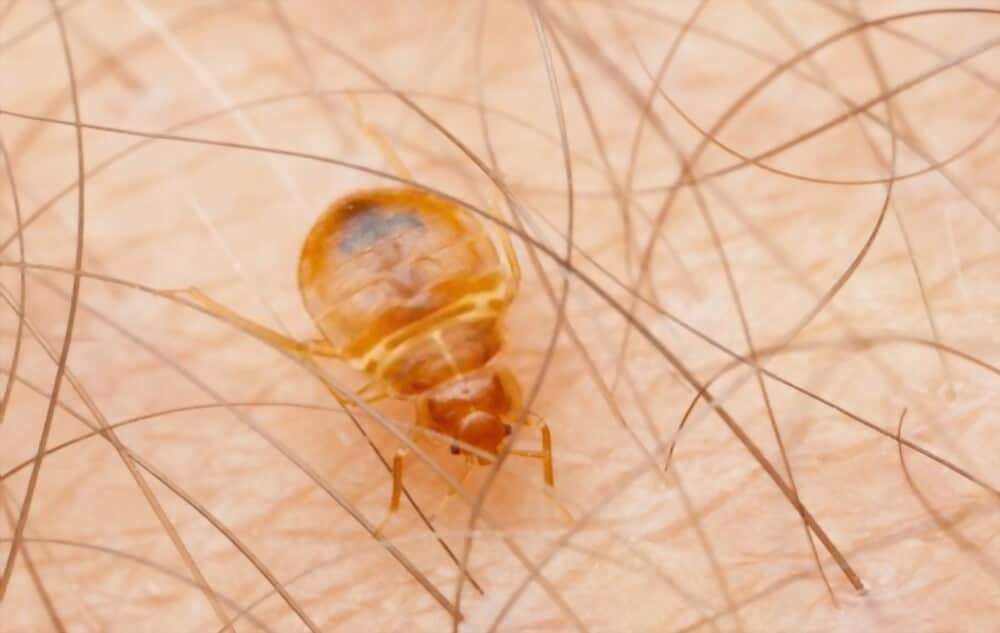 Bug Bite On Vagina