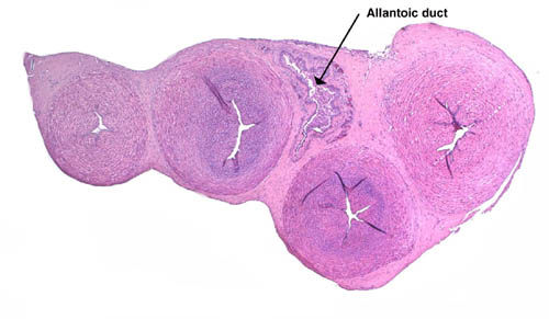 Section of thin umbilical cord with large allantoic duct at arrow. The blood vessels are conspicuously confined to the periphery of the duct