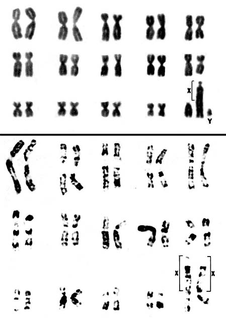 Chromosome karyotypes of male (above) and female Dorcas gazelles