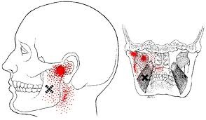 The medial and lateral pterygoid muscles