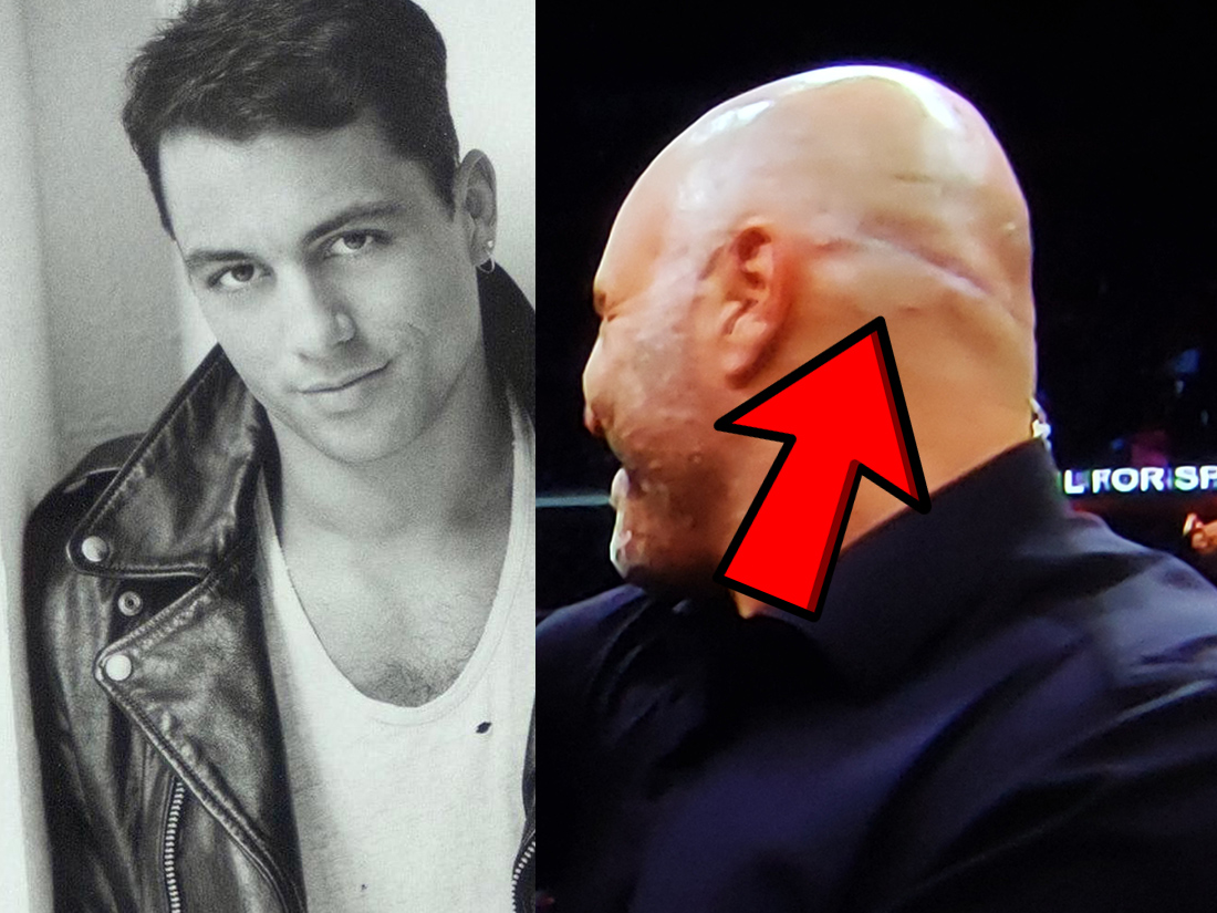 A before and after picture of Joe Rogan with hair loss: