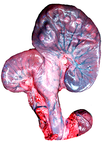 Unopened uterus of second gestation