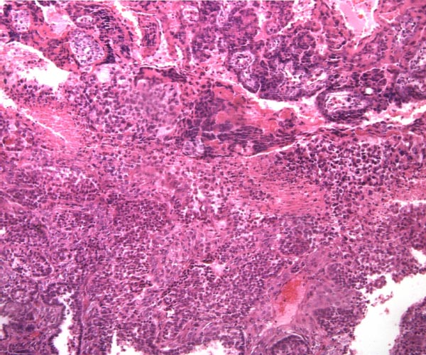 Maternal floor of tamarin placenta showing large maternal vessel surrounded but not invaded by trophoblast. Areas of necrosis and Nitabuch fibrin layer are apparent