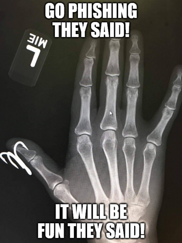 This image is not ours, but White Oak Security shares an image of an xray with a fish hook in the thumb. It says go phishing, it will be fun they said!