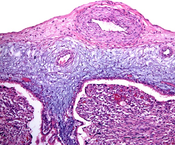 Fetal surface with bluish villi extending between broad maternal septa