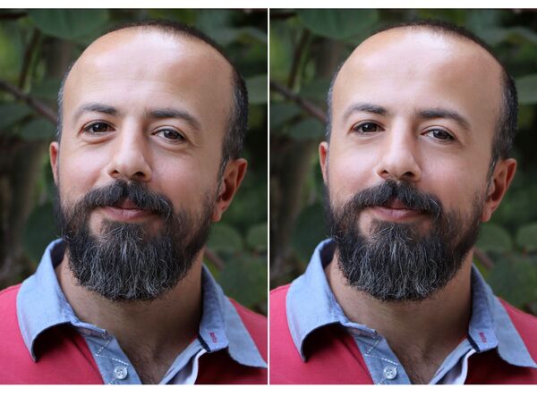 Homem calvo com barba e marcas de expressões. Antes e depois