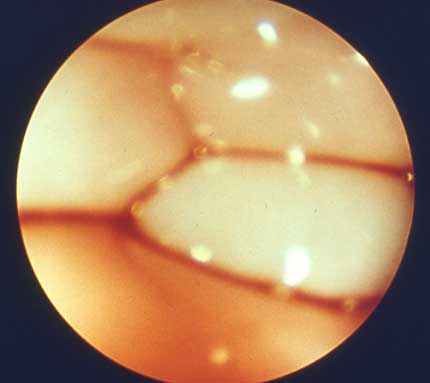 Vista cercana a de unos escasos centímetros cuadrados de mucosa vaginal canina obtenido durante el proestro usando un endoscopio de fibra óptica