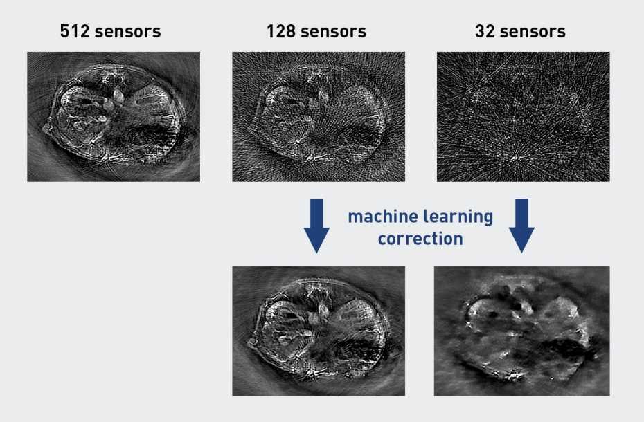 Three images show the difference between 512 sensors, 128, and 32. By applying machine learning, the two images with the least amount of sensors can look the same quality as the one with the most, or close to it.