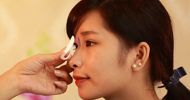 Phương pháp nâng mũi thẩm mỹ cấu trúc 4D thông thường phù hợp với dáng mũi tẹt