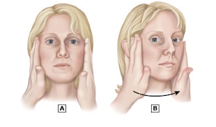 Head Impulse normal. A: paciente com cabeça centralizada e olhar fixo em determinado ponto; B: paciente mantém a fixação do olhar após rotação abrupta da cabeça