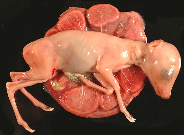 Midgestational pregnancy with nine cotyledons.