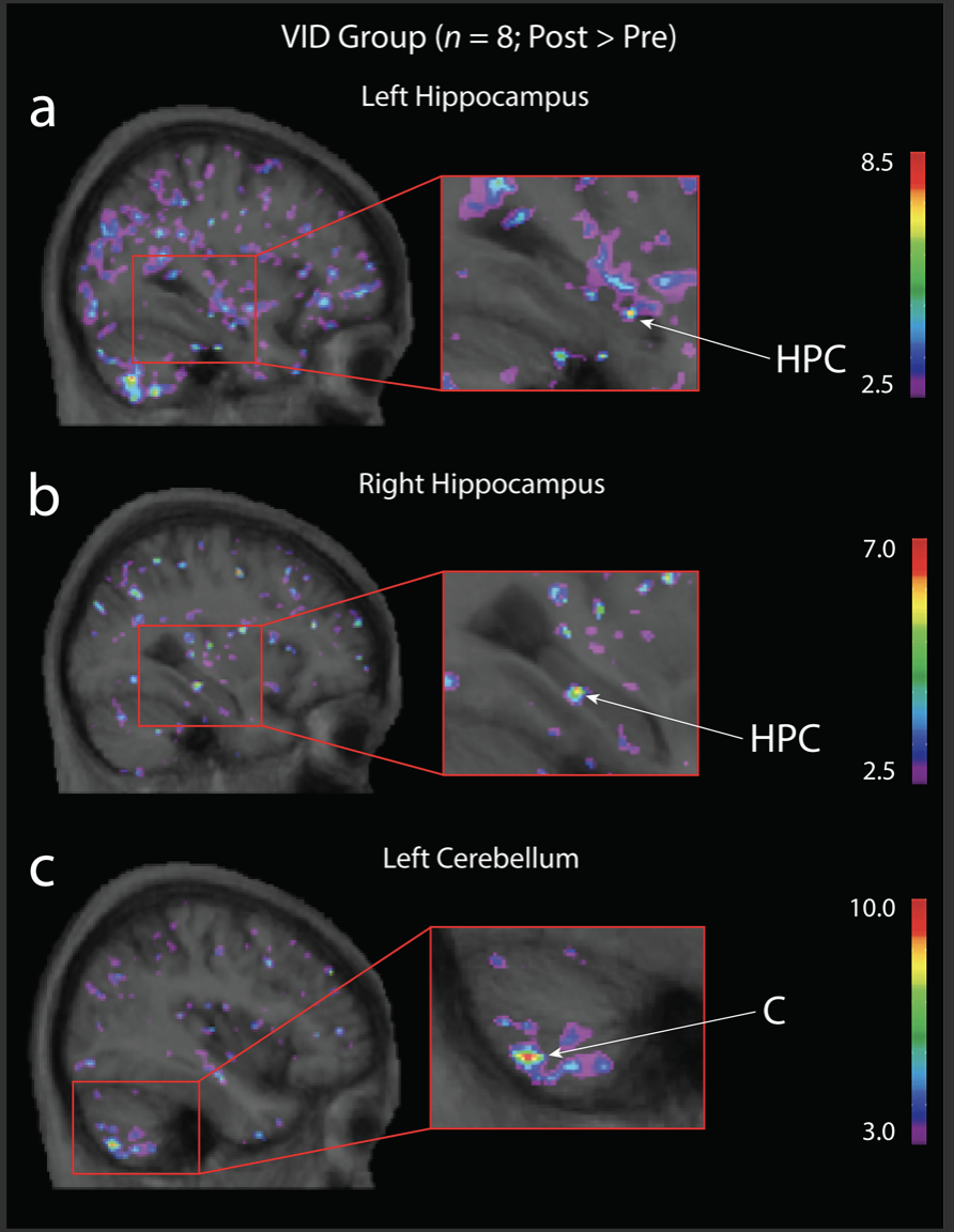 Brain Tune-Up from Action Video Game Play