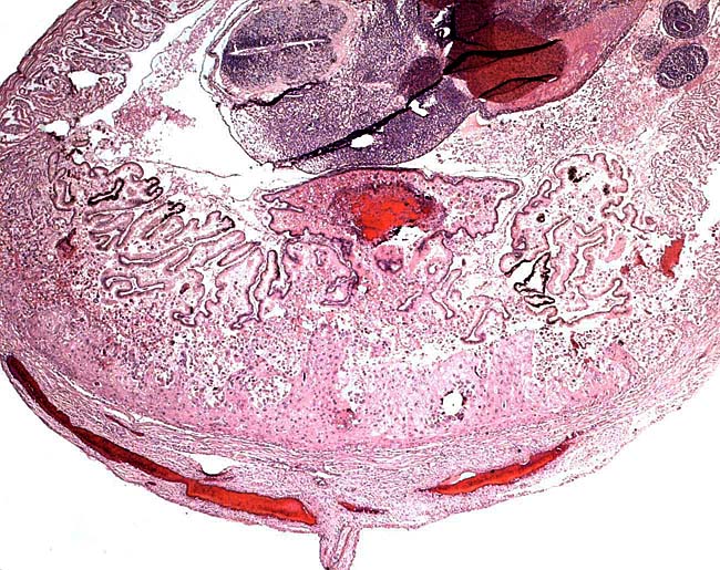 Mesometrium below, small placental disk with red blood in center, stalk connecting to subplacenta, adjacent to which is the folded endometrium.