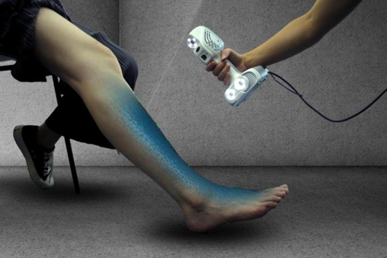 3D Scanning a leg