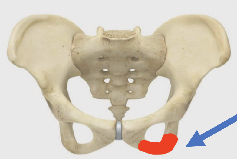uma bacia humana indicando a saliência óssea, localizada na área dos glúteos, tuberosidade isquiática