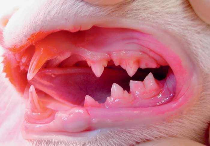 Supragingival dental plaque on healthy teeth and gums