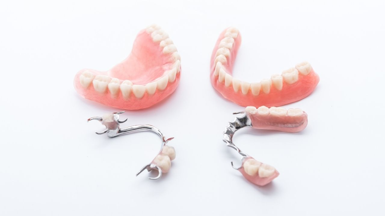 Dentadura: saiba tudo sobre esse tratamento, seus tipos e quanto custa