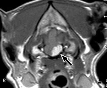 Transverse, post-contrast, T1-weighted image of a dog with brainstem meningioma