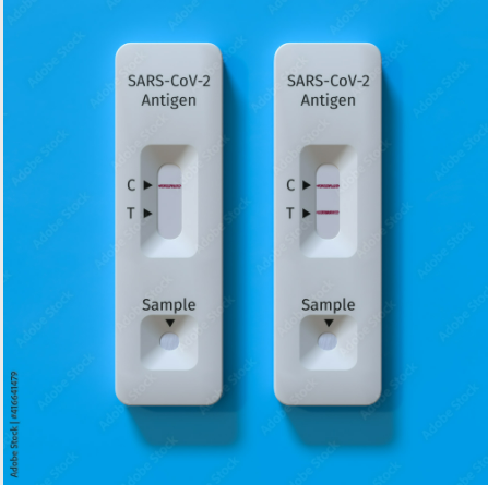 Teste rápido de antígeno para detecção do SARS-CoV-2 - avanços biotecnológicos na pandemia