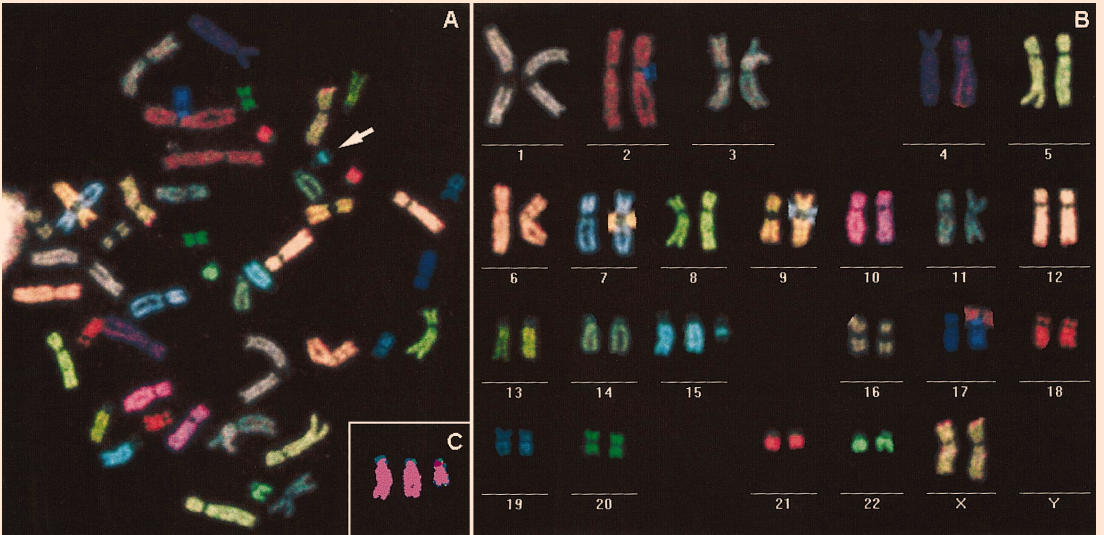 Fluorescent in situ hybridization (FISH) on karyotyped chromosomes using a different color probe for each chromosome. This test can be used to identify genetic anomalies in parents or fetus.