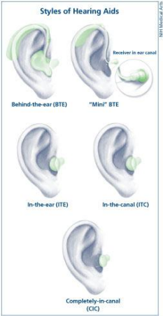 Styles of hearing aids for hearing loss