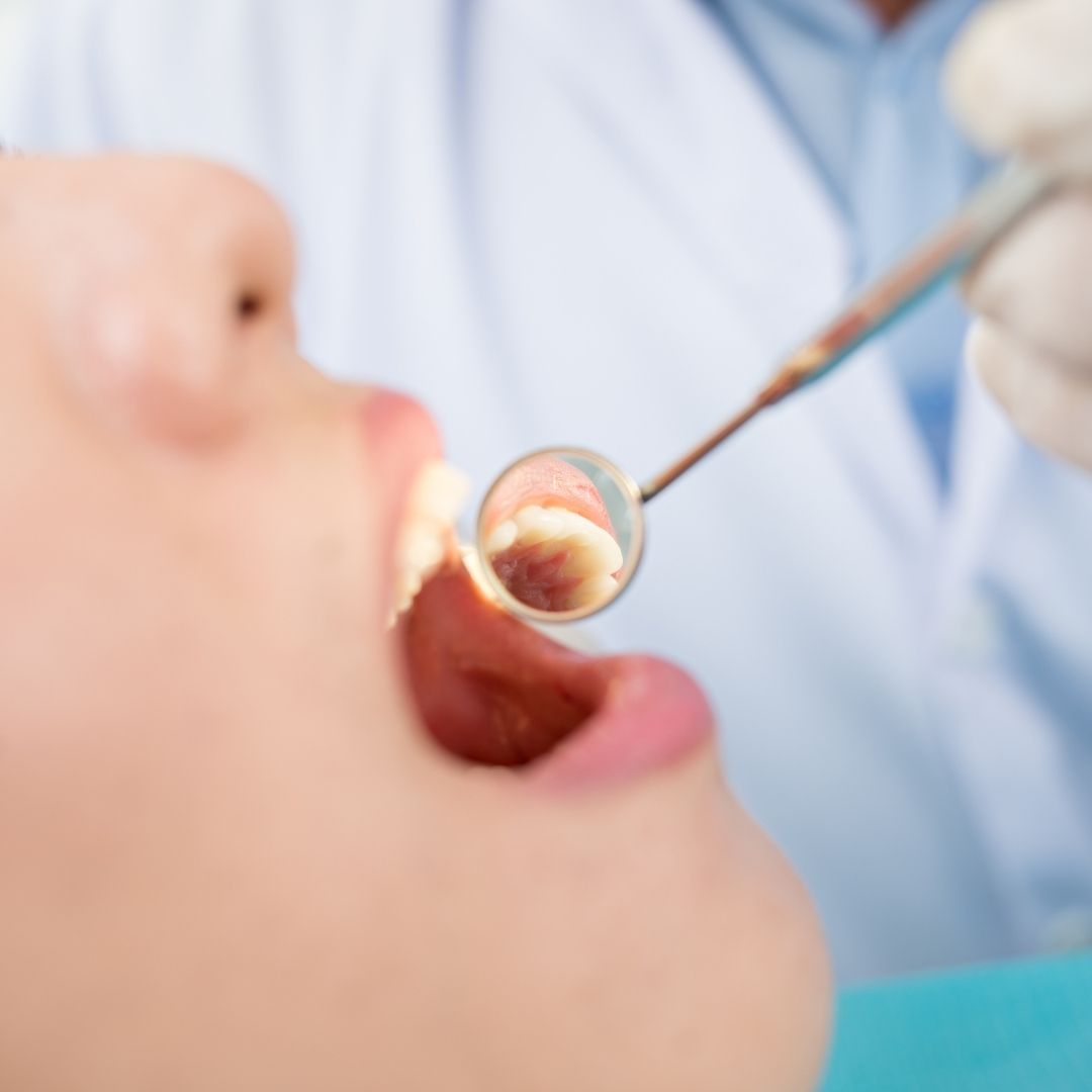 Patients Dental checkup