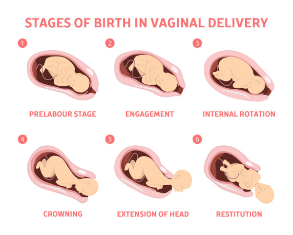 Stages of Birth