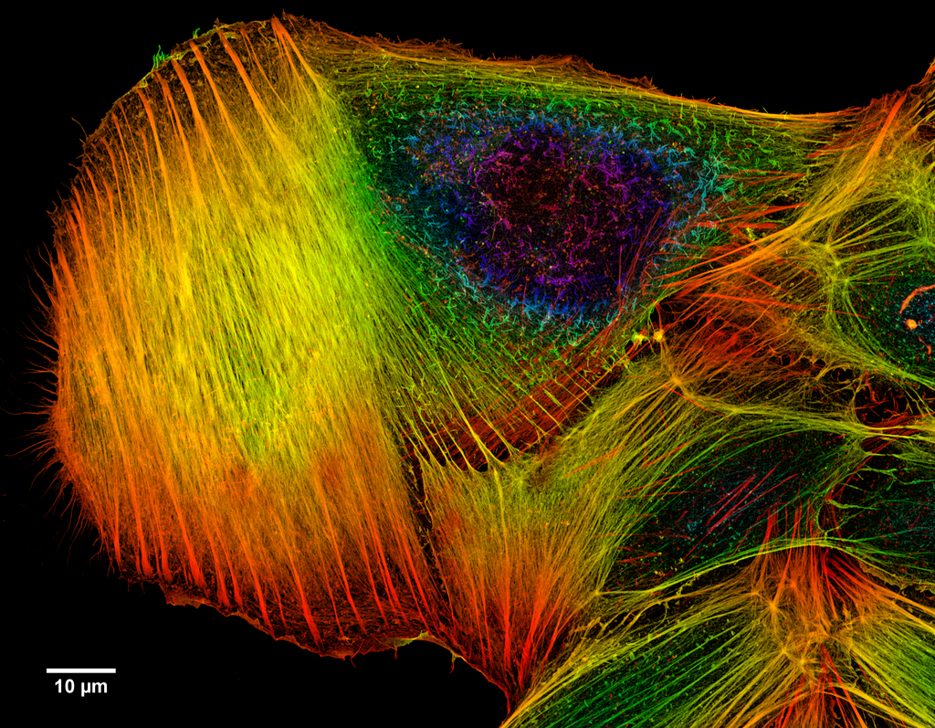 Depth_Coded_Phalloidin_Stained_Actin_Filaments_Cancer_Cell.png
