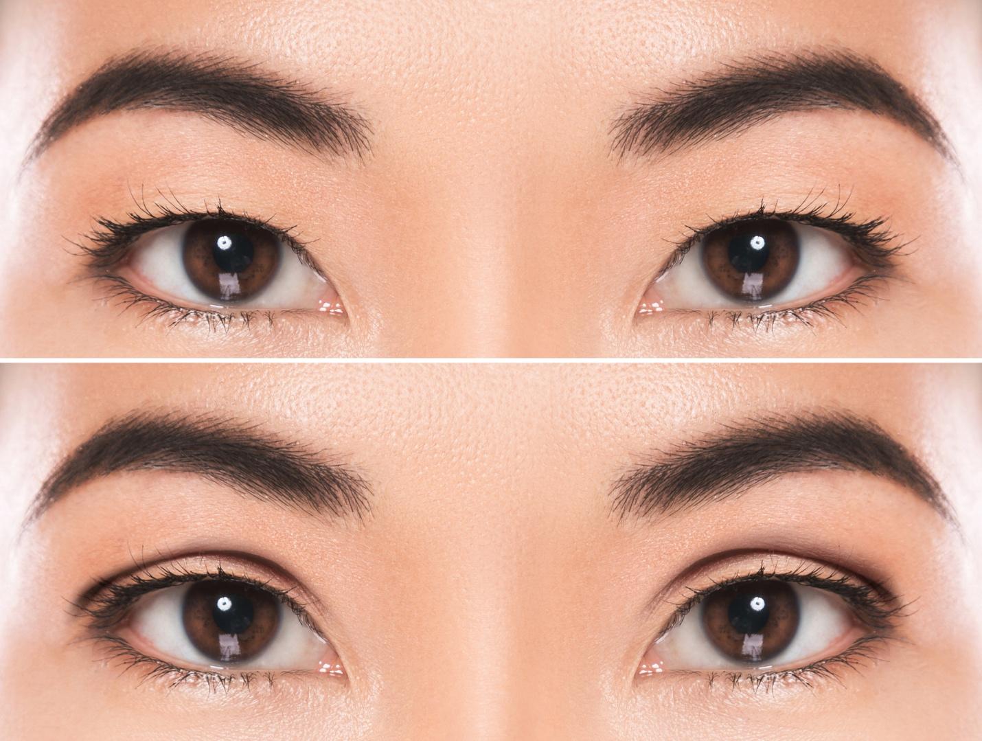 A brow lift or eyelid lift in men and women can open up the eyes and revitalize your appearance