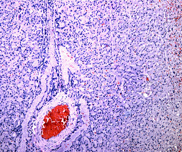 Trophospongium of immature placenta. Maternal blood vessels.
