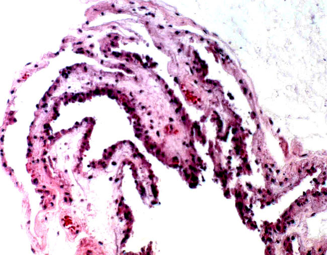 Placental surface in the uninflamed region