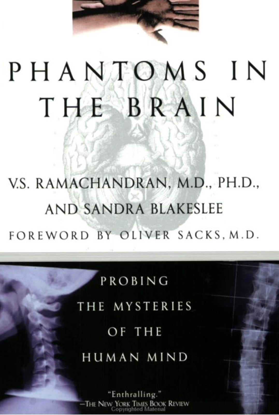Phantom in the brain.png
